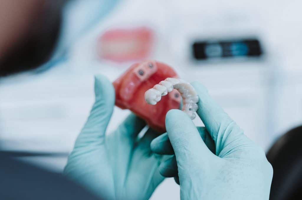 dentista en valencia experto en prótesis dentales