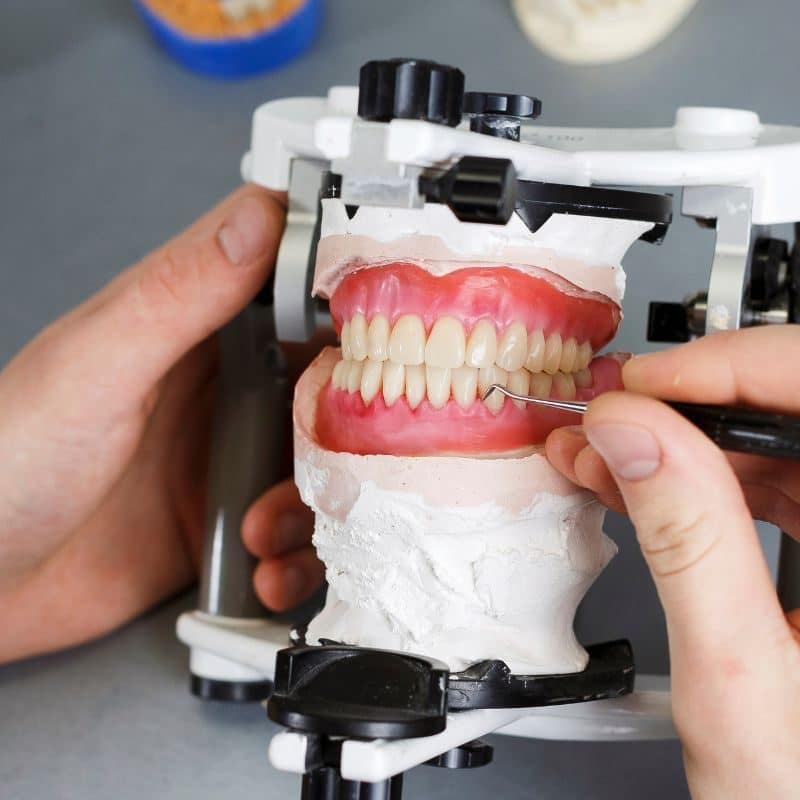 Tipos de Prótesis Dental Fija: Una Guía Completa